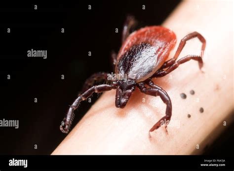 Image result for Embedded Deer Tick