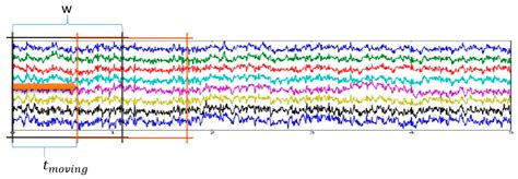 Efficient Classification of Motor Imagery Electroencephalography ...