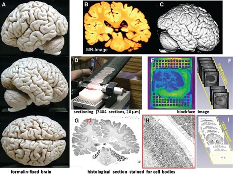 Brain Model 的图像结果