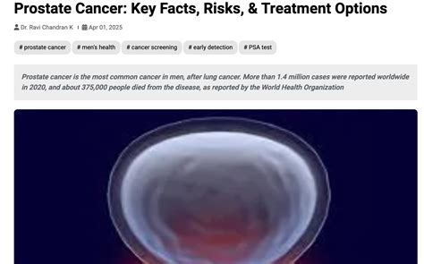 Prostate Cancer: Key Facts, Risks, & Treatment Options - Trigone Clinic