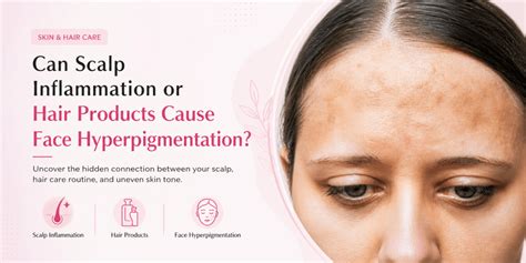 Hyperpigmentation of the Lips: Causes, Safe Treatments, and Prevention ...