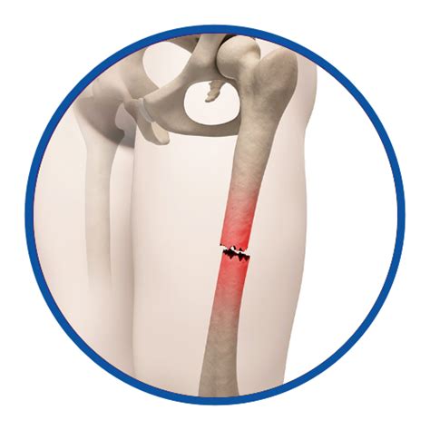 Dr. Vicky Gandhi | Orthopaedician