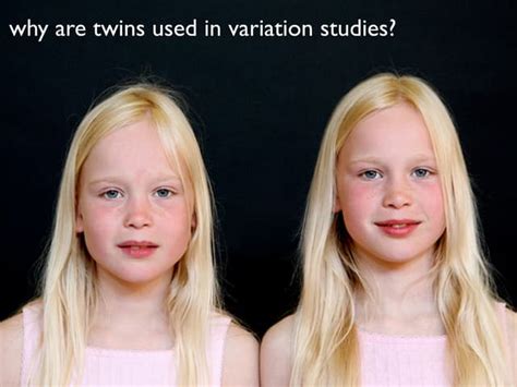 Image result for What iOS a Developmental Variation