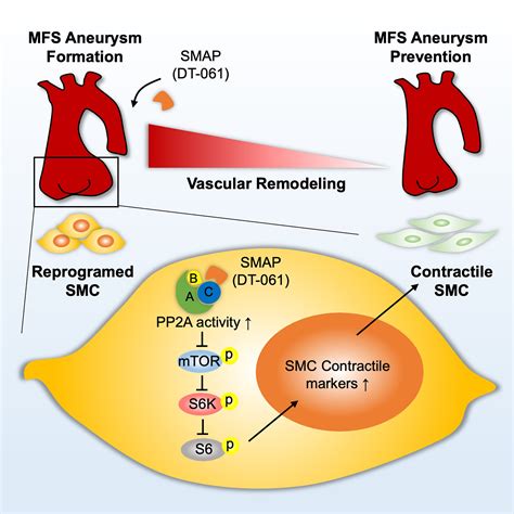 PP2A Attenuates Thoracic Aneurysm and Dissection in Mouse Models of ...
