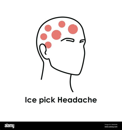 Ice pick headache hi-res stock photography and images - Alamy
