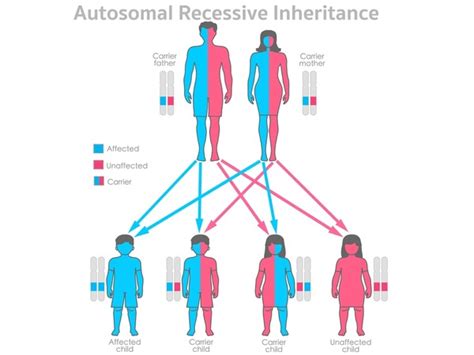 Image result for Inheritance Allele