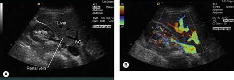 Image result for Ultrasound Lab