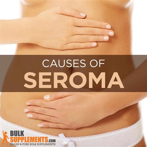 What is a Seroma: Causes, Characteristics & Treatment