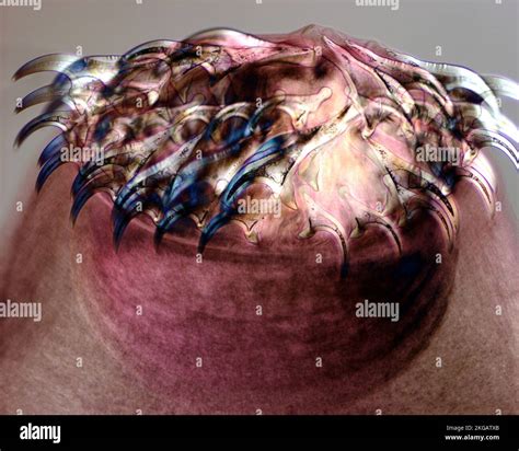 Tapeworm head, light micrograph. Adult tapeworms (Tinea sp.) are ...