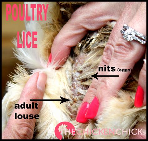 Chicken Lice On Humans