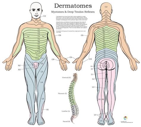 Image result for Spinal Nerve Root Block