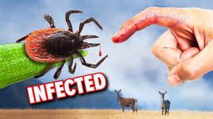 Image result for Embedded Deer Tick