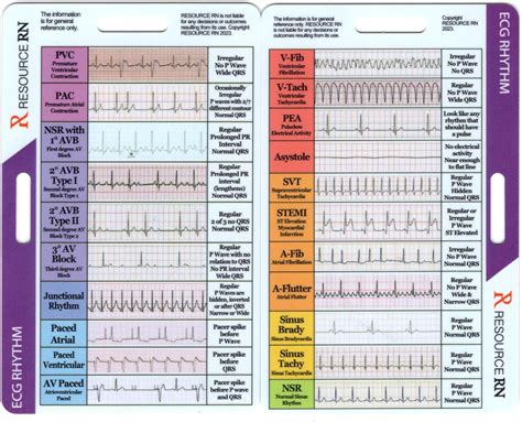 EKG Rhythm Interpretation - Compact & Portable Reference Card – Rapid ...
