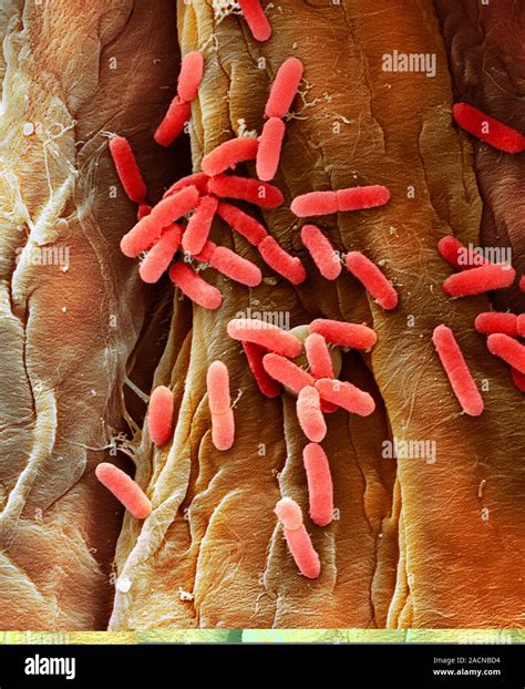 E. coli bacteria. Coloured scanning electron micrograph (SEM) of Escherichia coli (E. coli ...