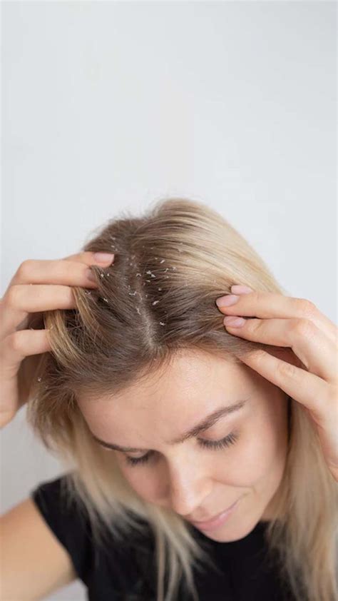 Best Treatments for Skin Infections in Pragathi Nagar, Kukatpally ...