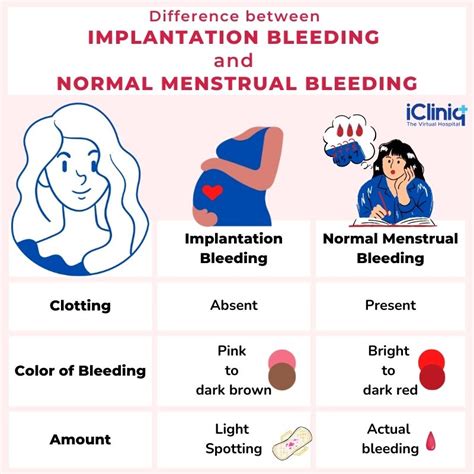 Implantation Bleeding - Types | Causes | Symptoms