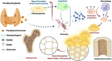 Hungry Bone Syndrome After Parathyroidectomy for Secondary ...