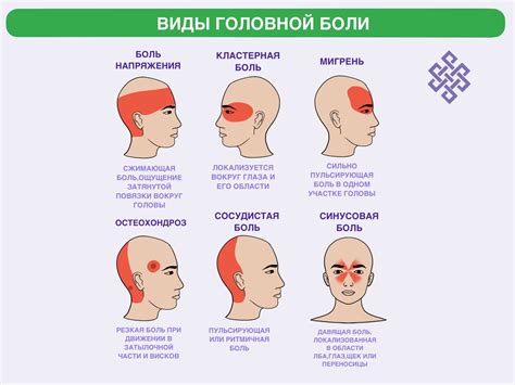 Виды головных болей: от мигрени до кластерных приступов