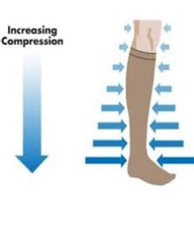 Medical treatment for Varicose veins in chennai, Compression therapy ...