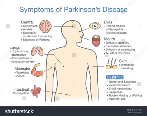 How Does Parkinson's Kill You