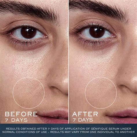 Lancôme Advanced Genifique Youth Activating Serum | Buy Premium Serum