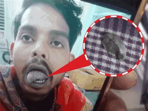 Meerut Doctors Fail Reattach Tongue | Victim Loses Speech