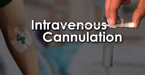 IntraVenous Cannulation