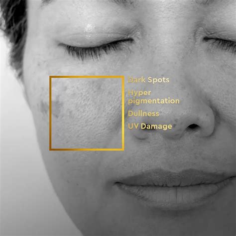 Buy Best Anti Pigmentation Regime - VLCC