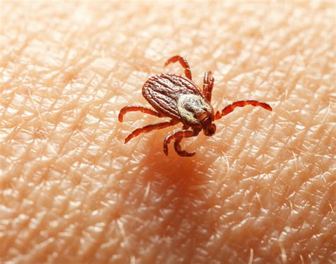 What Instantly Kills Ticks? The Only Guide You Need