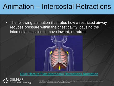 What Is Retraction Breathing at Paul Hines blog