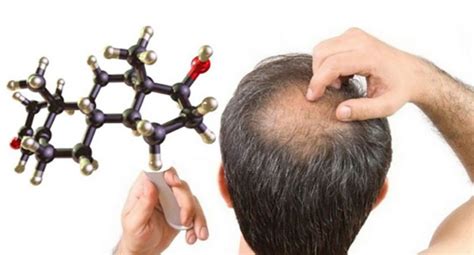 如何治疗脱发 五个治脱发的中医方法！ - 知乎