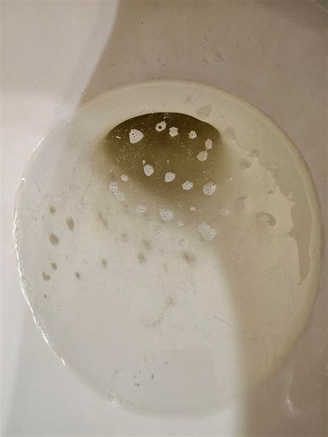 Thoughts on my urine : r/foamyurine