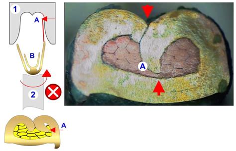 Crimp Types 的图像结果