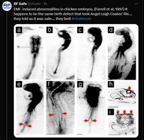 RF Safe From Loss to Legacy: Championing EMF Safety in Memory of Angel ...