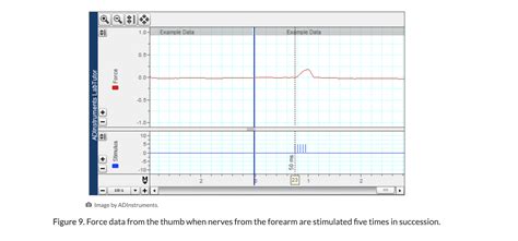 Image result for Muscle Twitch Graph