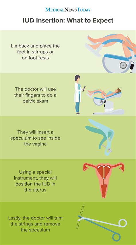 IUD insertion: A guide and what to expect