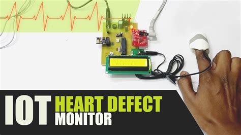 Iot Based Heart Monitoring System Using ECG 的图像结果