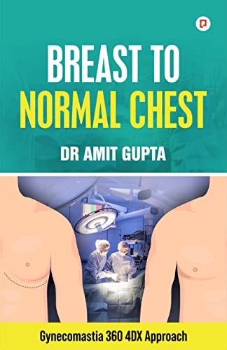 Breast to Normal Chest: Gynecomastia 360 4DX Approach eBook : Gupta, Dr ...