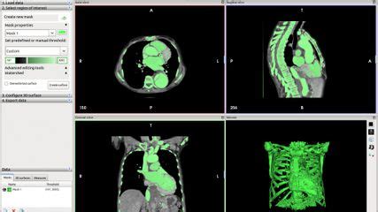 InVesalius Tutorial 的图像结果