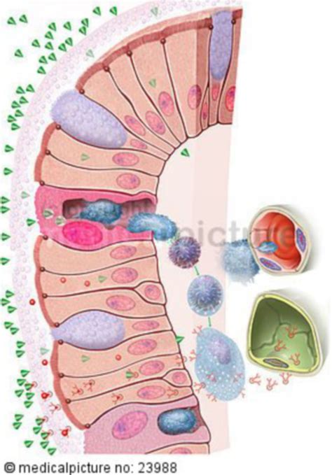 Mucosa-associated lymphoid tissue (MALT) - DocCheck