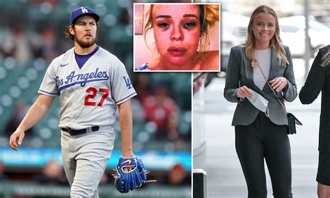 Trevor Bauer, Lindsey Hill, Agree To Settle Lawsuits With Each Other ...