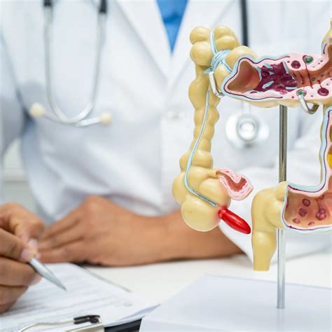 Image result for Open Colon Surgery