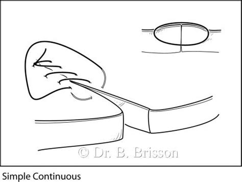 Image result for Continuous Suture Patterns