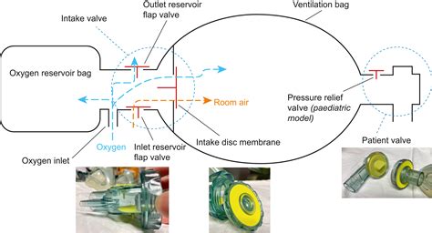 Understanding your bag-valve-mask resuscitator - BJA Education