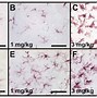 Image result for Microgliosis