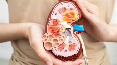 Reverse kidney damage naturally: Foods and habits for reducing ...