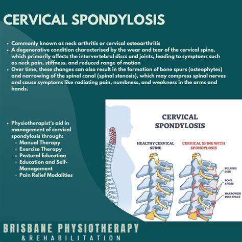 What Is Cervical Spondylosis? - Brisbane Physiotherapy & Podiatry