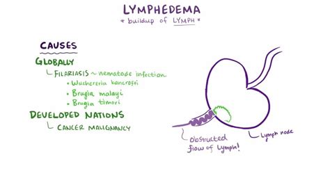 Image result for Lymphatic System Disorders