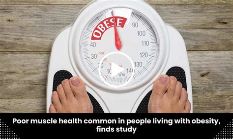 Poor muscle health common in people living with obesity, finds study