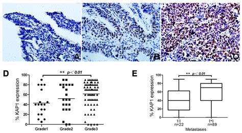 High Levels of KAP1 Expression Are Associated with Aggressive Clinical ...